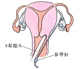 幼儿学画画，长沙捐卵宝宝学画画，学画画的好处，如何学画画