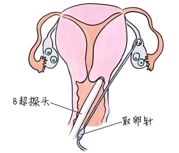 幼儿学画画，长沙捐卵宝宝学画画，学画画的好处，如何学画画